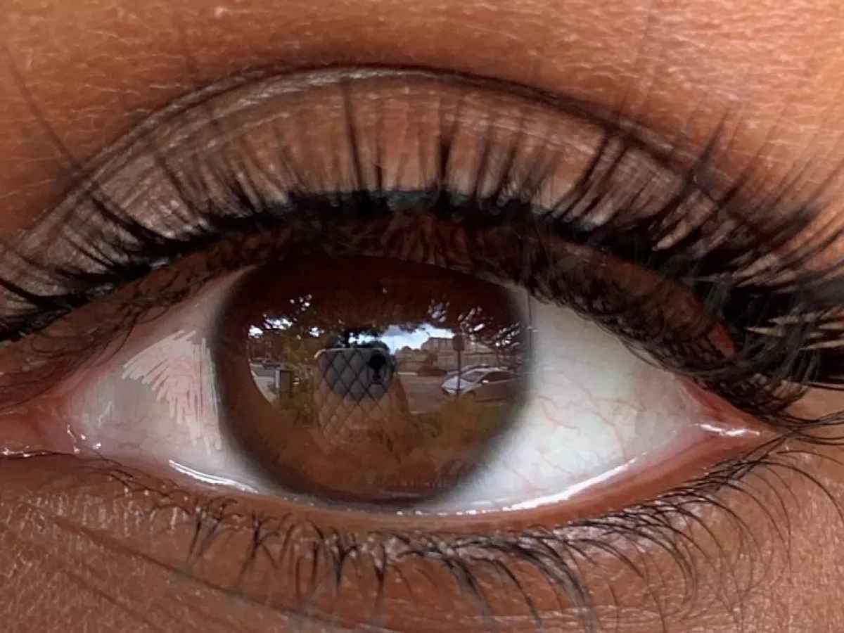 Sierra Davey eye